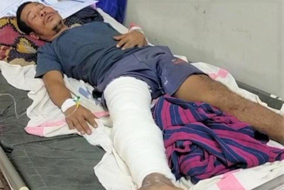 Amarpur : Man injured after gun shot by brother in-law Amarpur : Man injured after gun shot by brother in-law